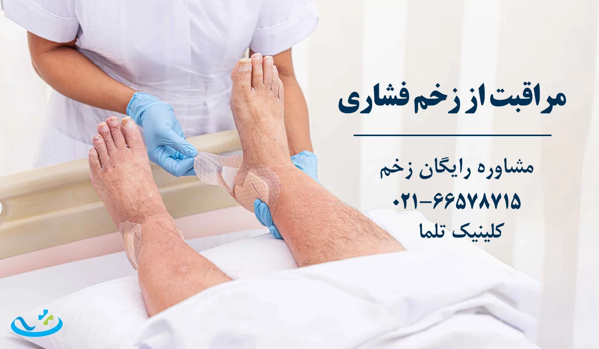 مراقبت از زخم بستر