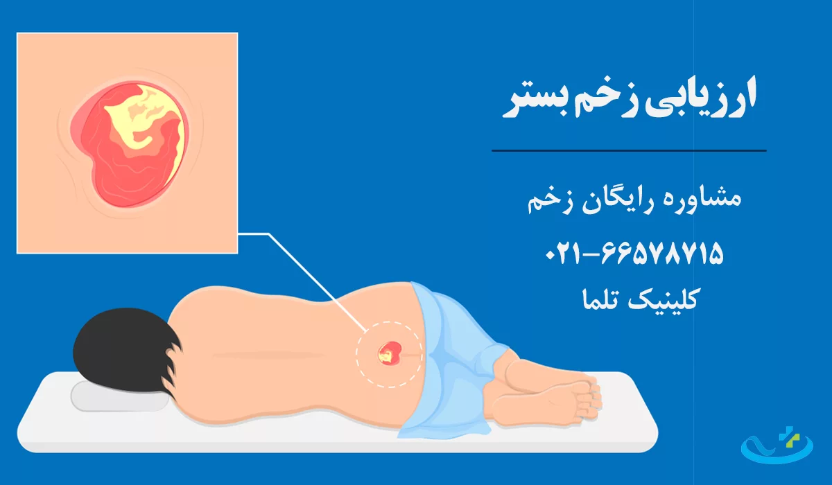 ارزیابی زخم بستر