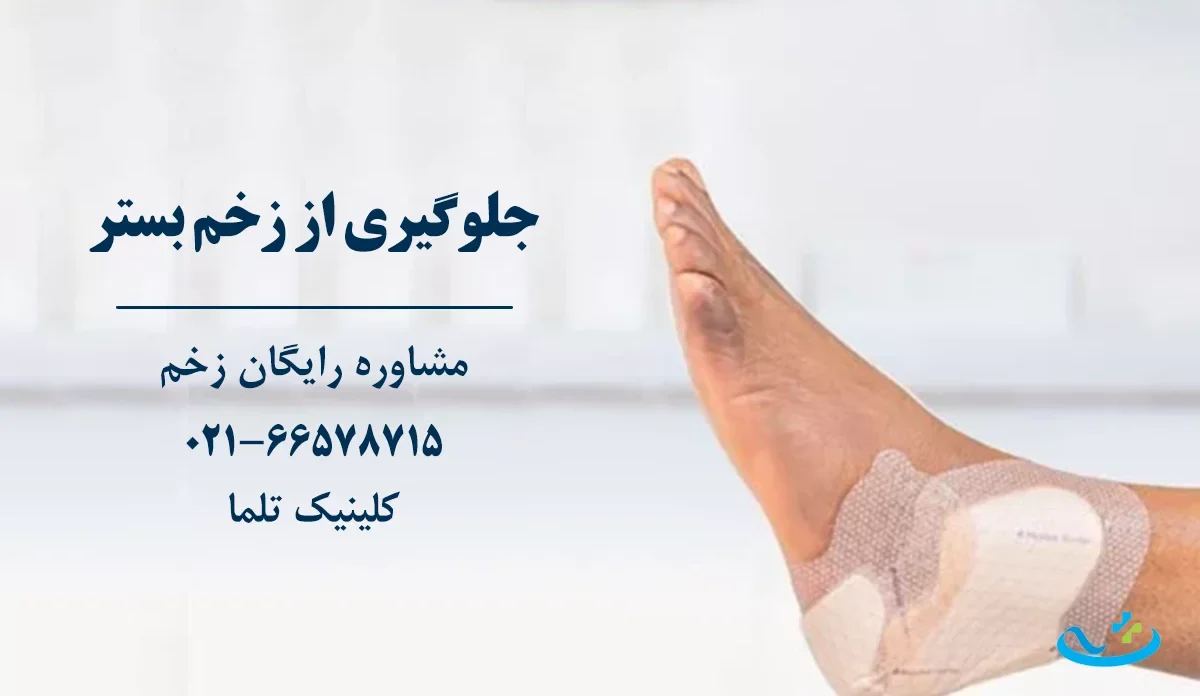 پیشگیری از زخم بستر