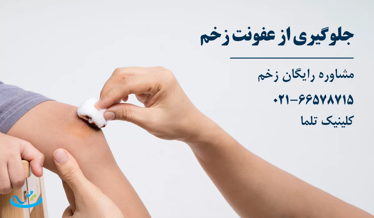 جلوگیری از عفونت زخم