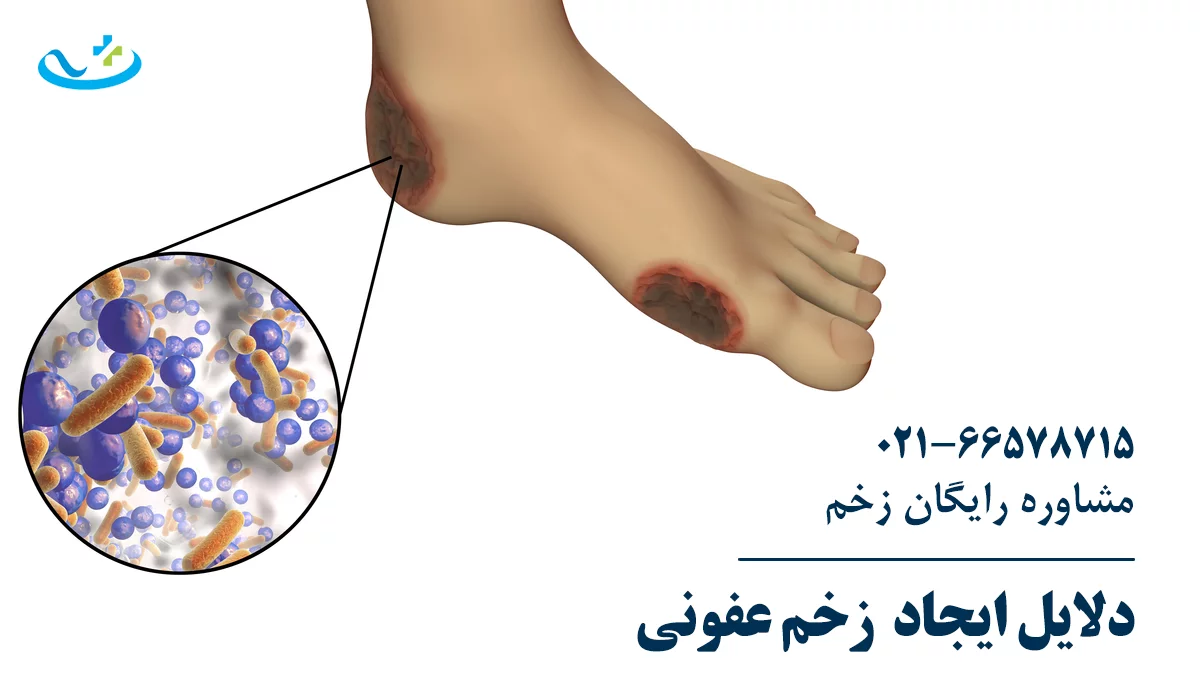 دلایل ایحاد زخم عفونی