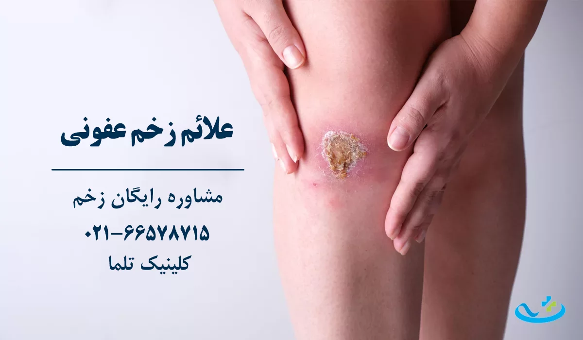 علائم زخم عفونی