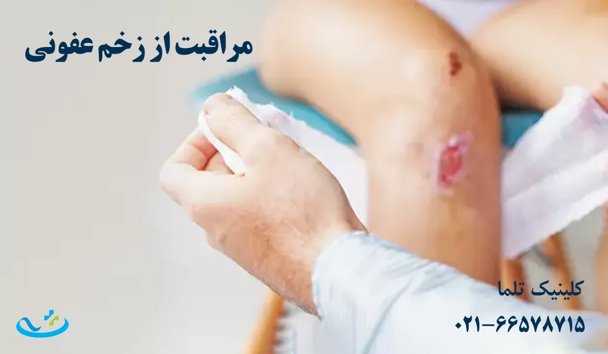 مراقبت از زخم عفونی