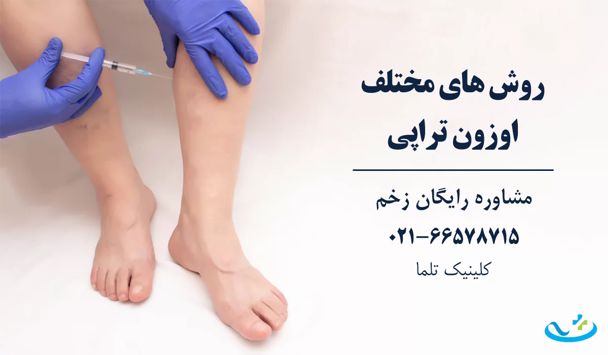 روش های اوزون تراپی زخم