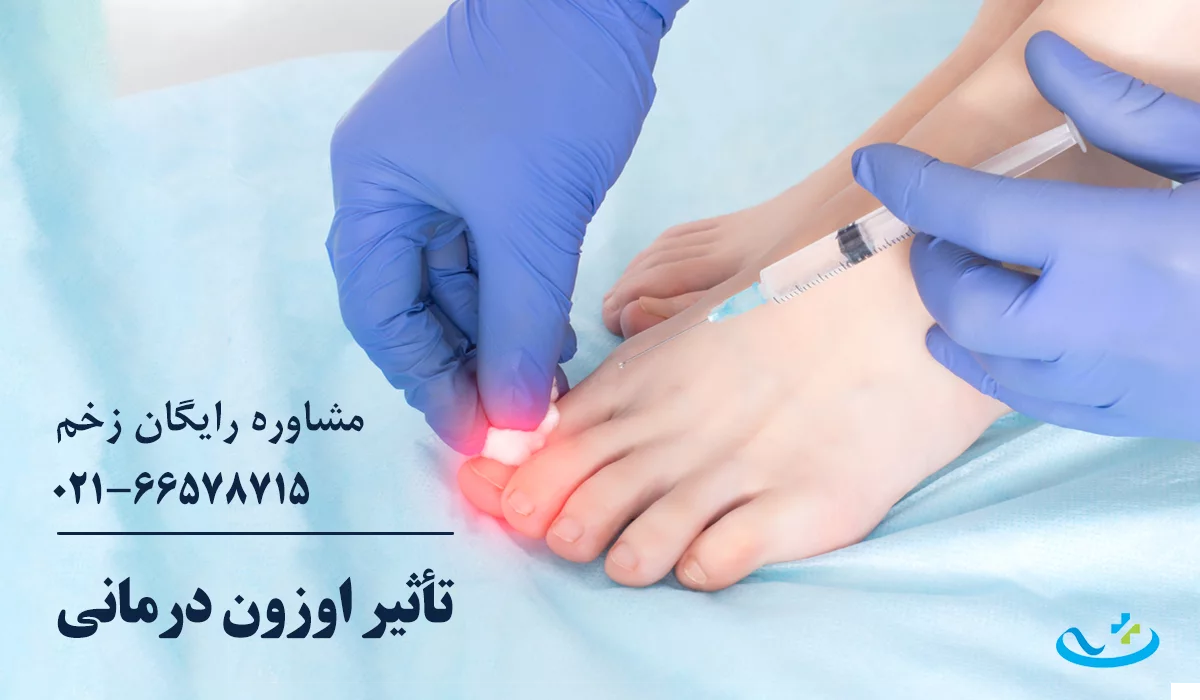 مکانیسم اثر اوزون تراپی