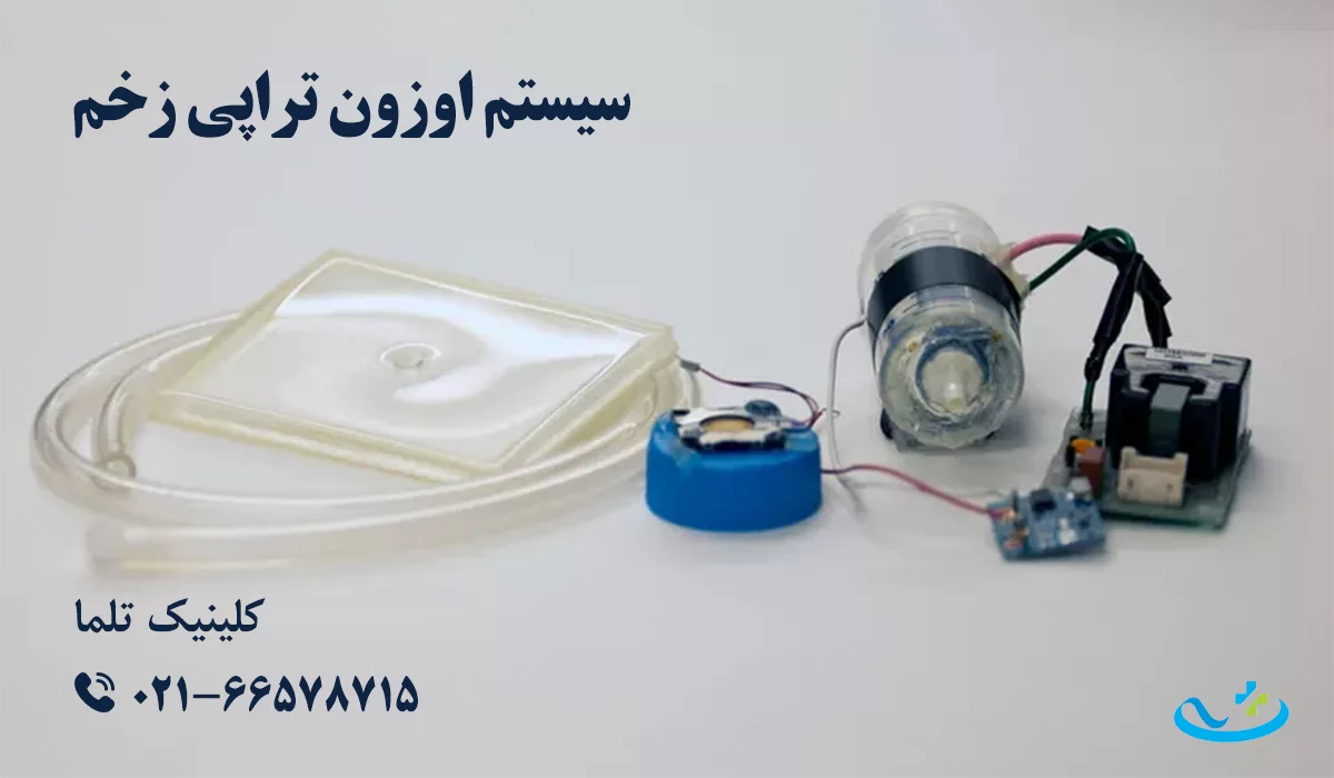 سیستم اوزون تراپی