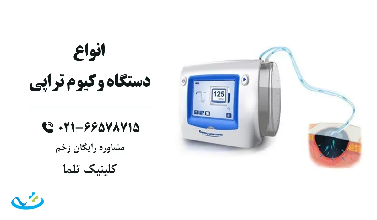 انواع دستگاه وکیوم تراپی زخم
