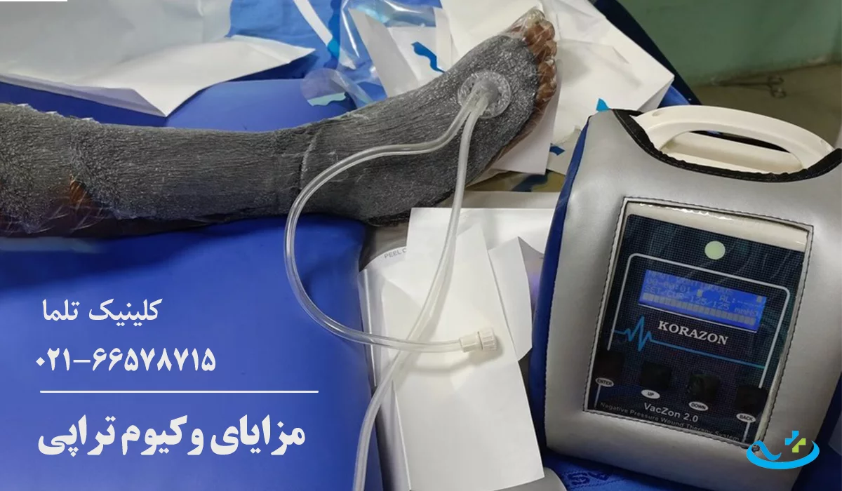 مزایای وکیوم تراپی زخم