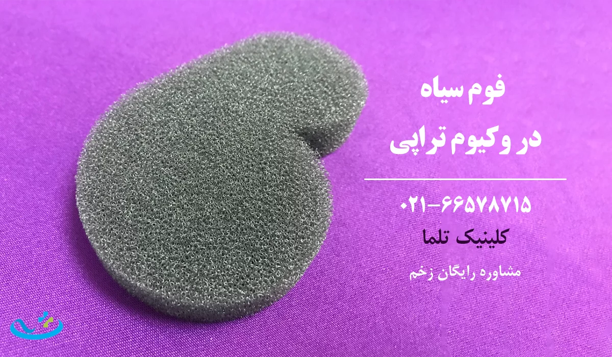 پانسمان فوم سیاه در وکیوم تراپی