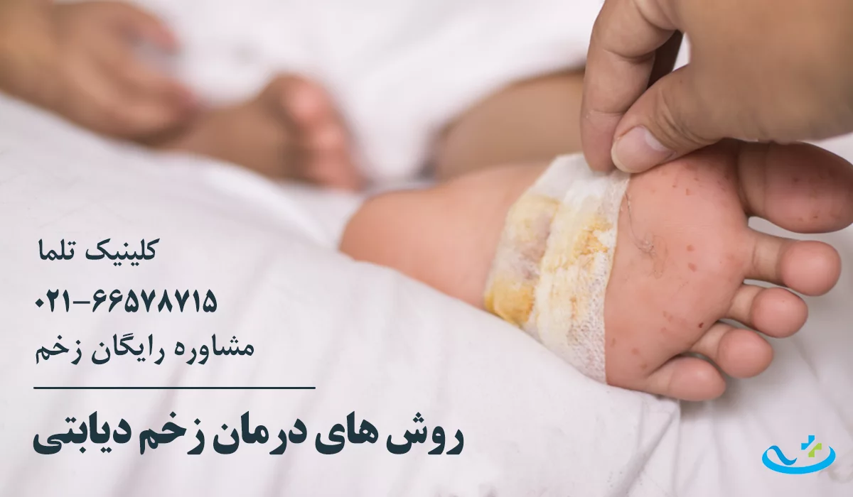 روش های درمان زخم دیابتی