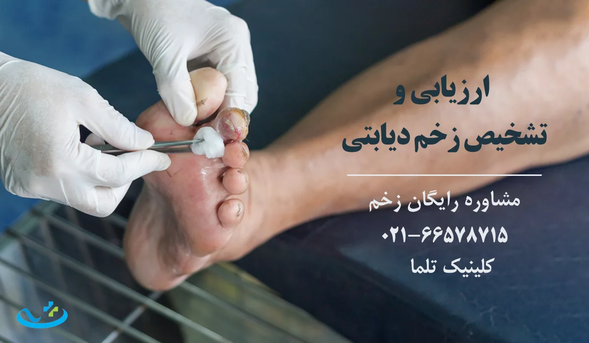 مراحل تشخیص در کلینیک درمان زخم دیابت