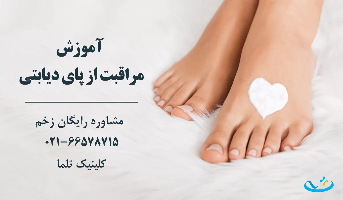 آموزش مراقبت از زخم پای دیابتی