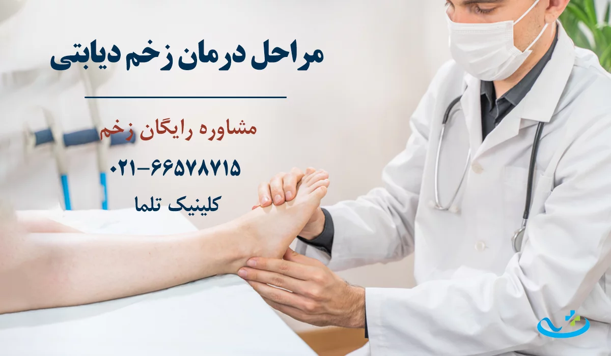مراحل درمان زخم دیابتی