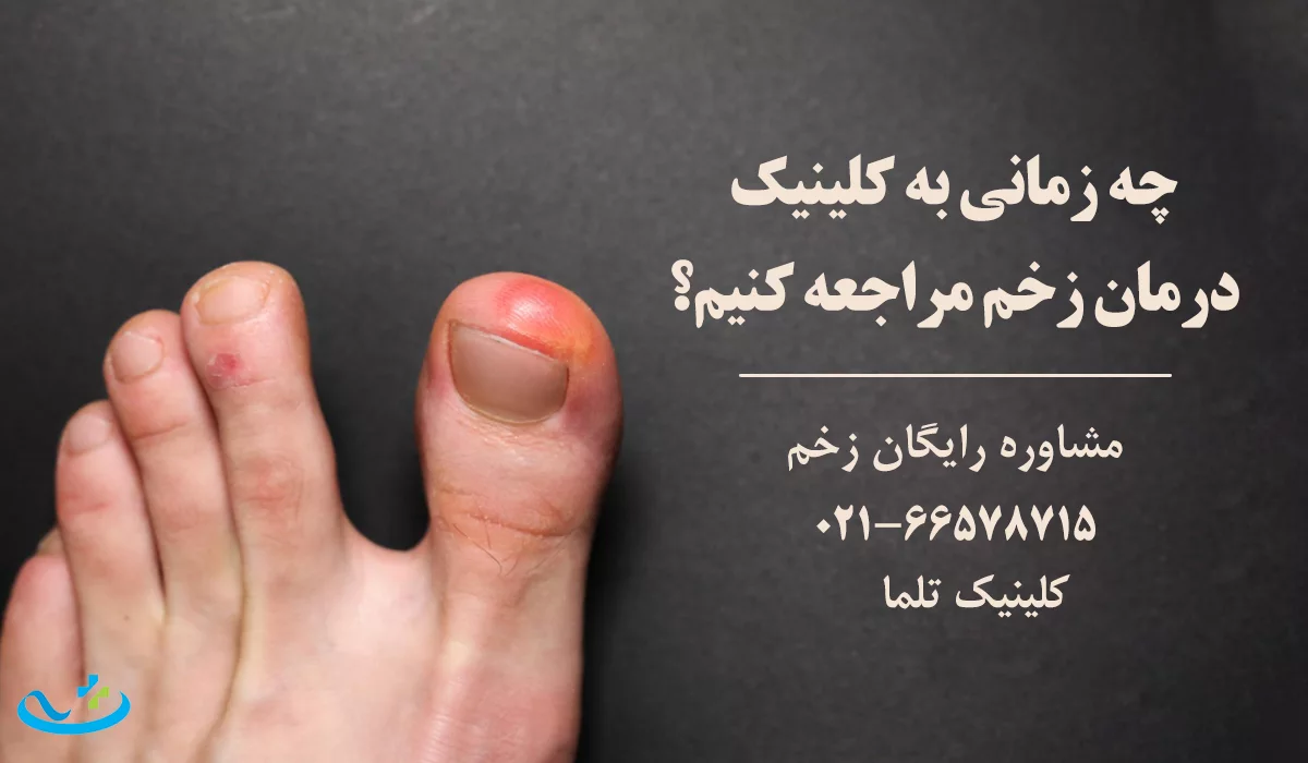 چه زمانی به کلینیک درمان زخم دیابت مراجعه کنیم