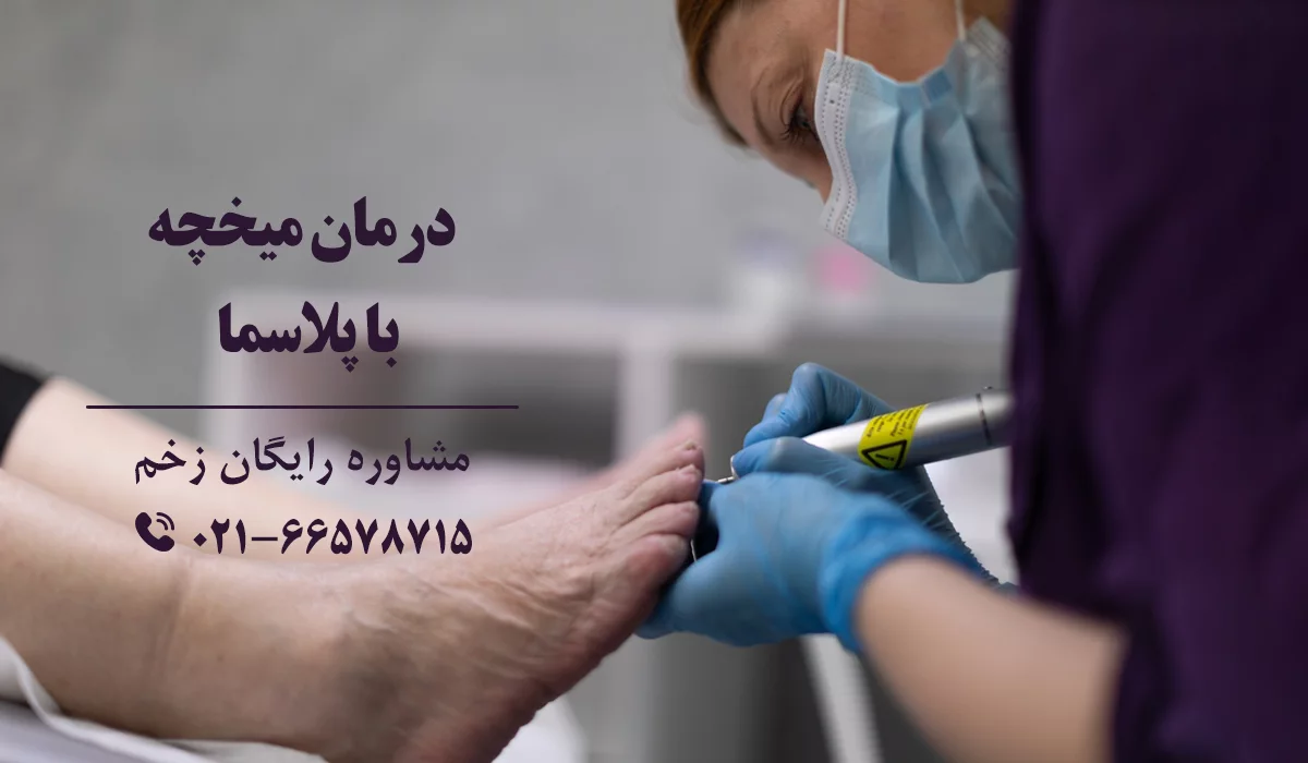 درمان میخچه با پلاسما