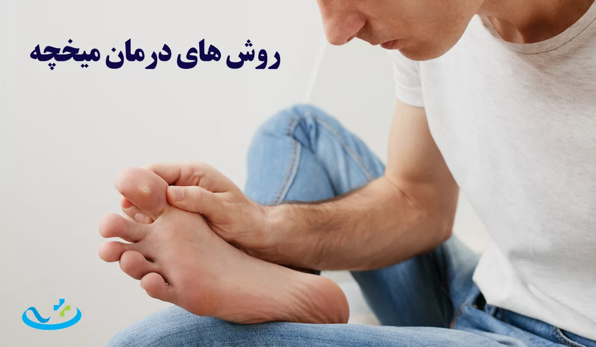 روش های درمان میخچه