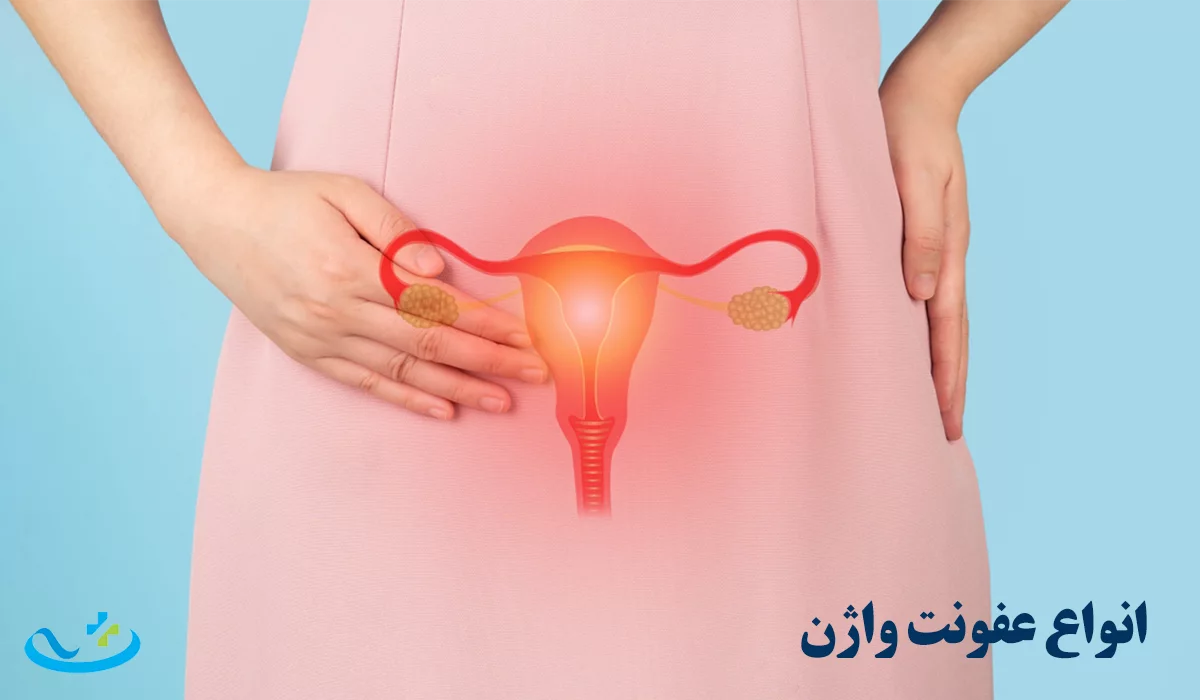 انواع عفونت واژن