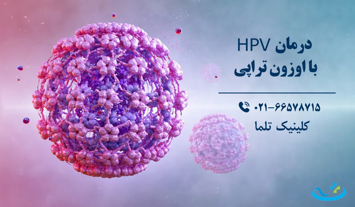 درمان hpv با اوزون