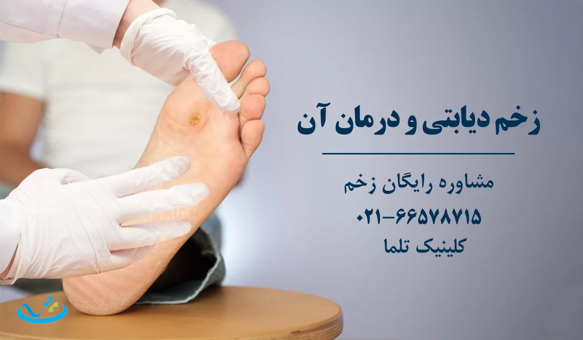 درمان زخم دیابتی
