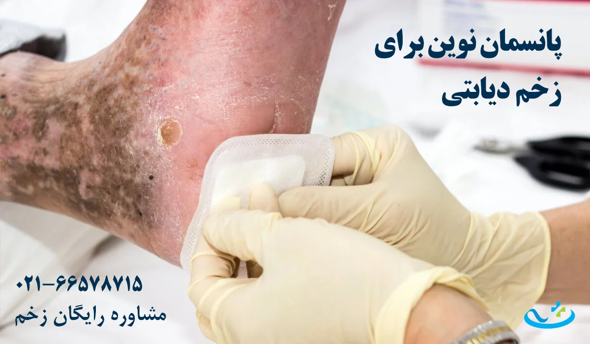 پانسمان درمان زخم دیابتی