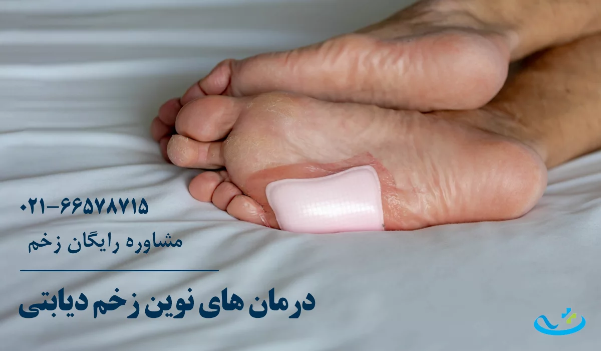 روش های درمان زخم دیابتی