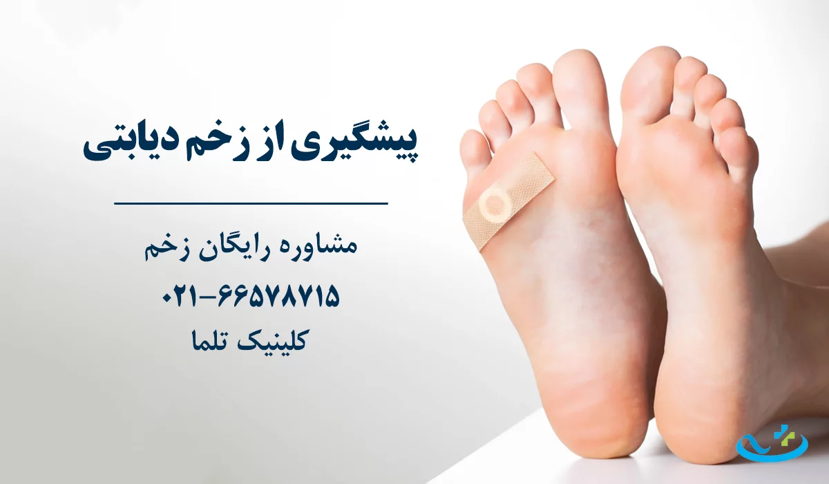 پیشگیری از زخم دیابتی