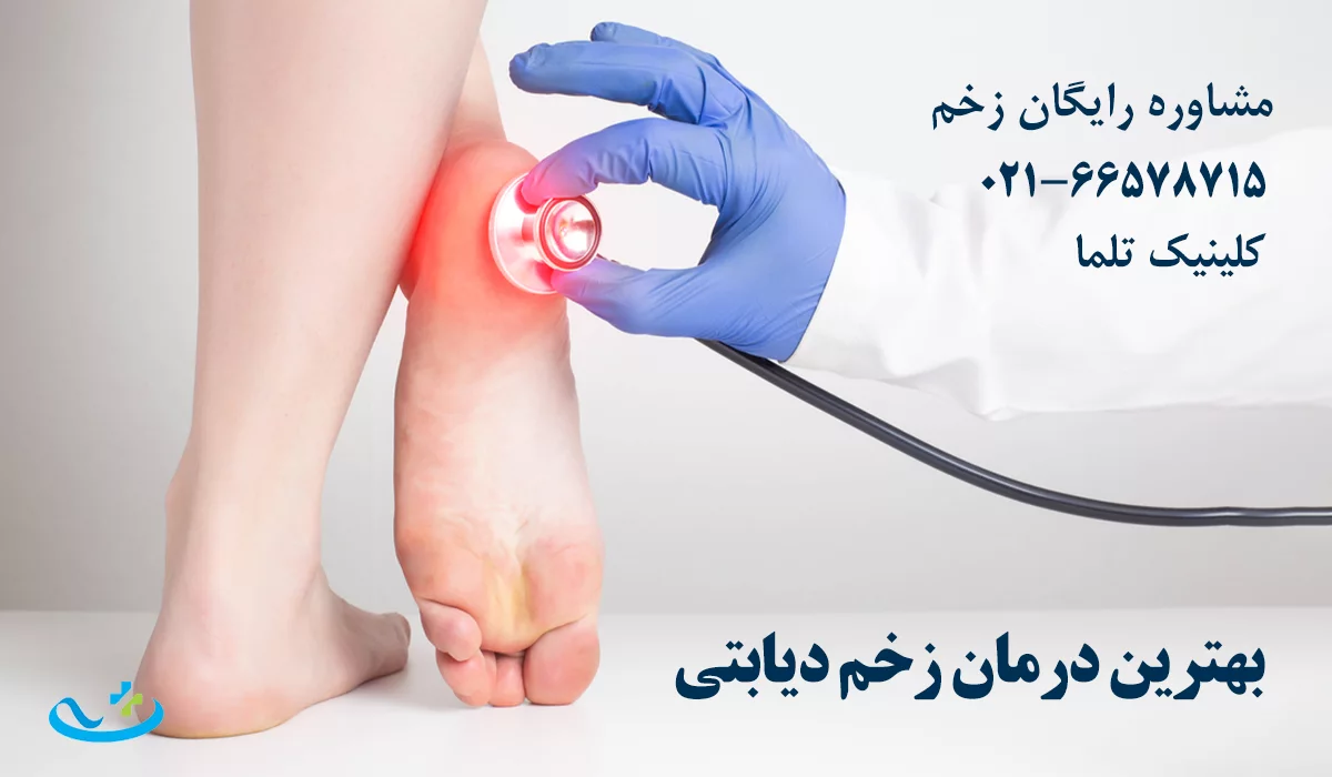 بهترین درمان زخم دیابتی