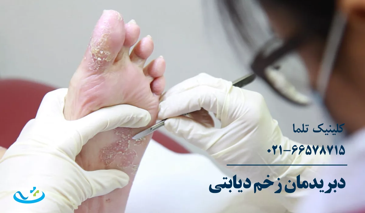 دبریدمان زخم دیابتی