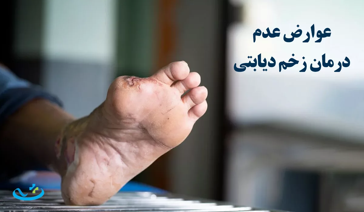 عوارض عدم درمان زخم دیابتی