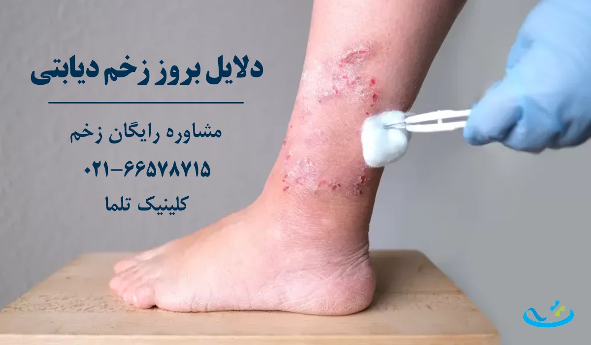 دلایل بروز زخم دیابتی