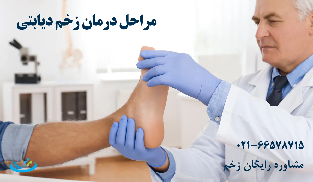 مراحل درمان زخم دیابتی