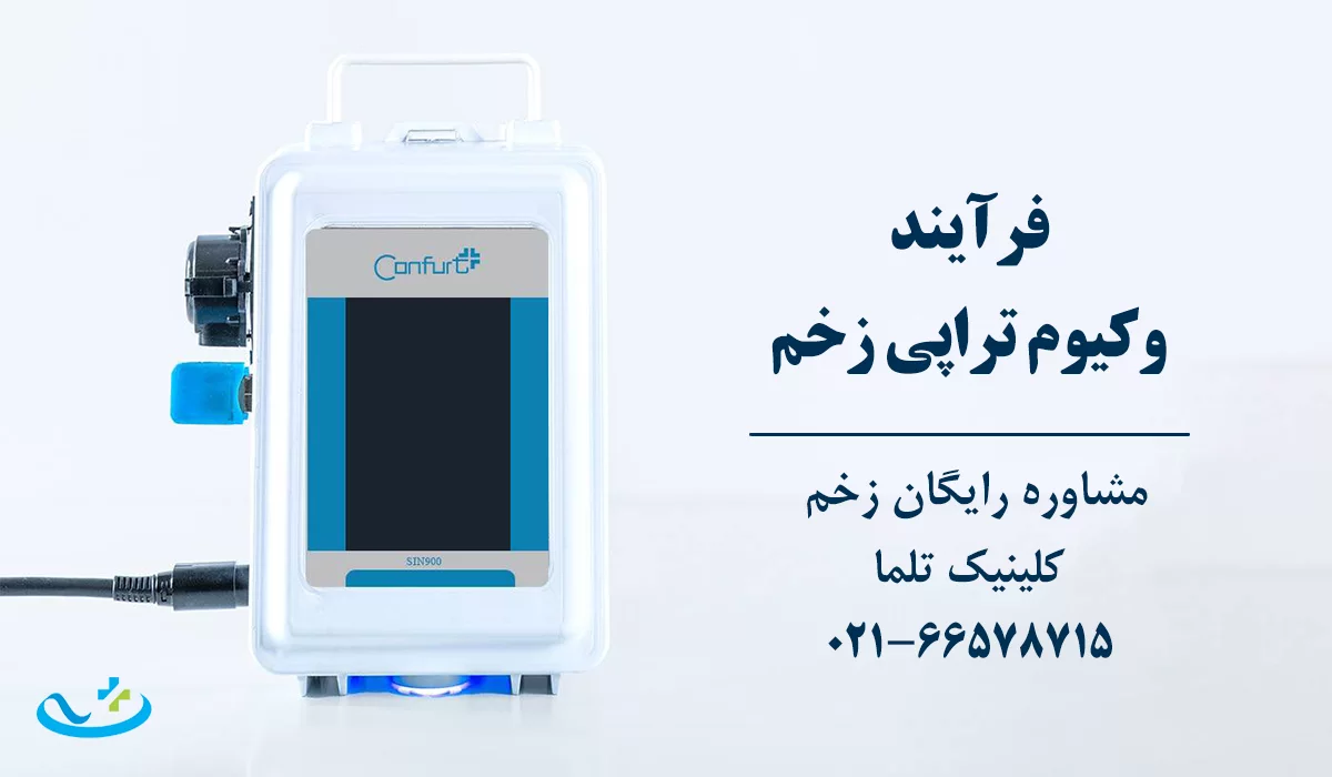 فرآیند وکیوم تراپی زخم