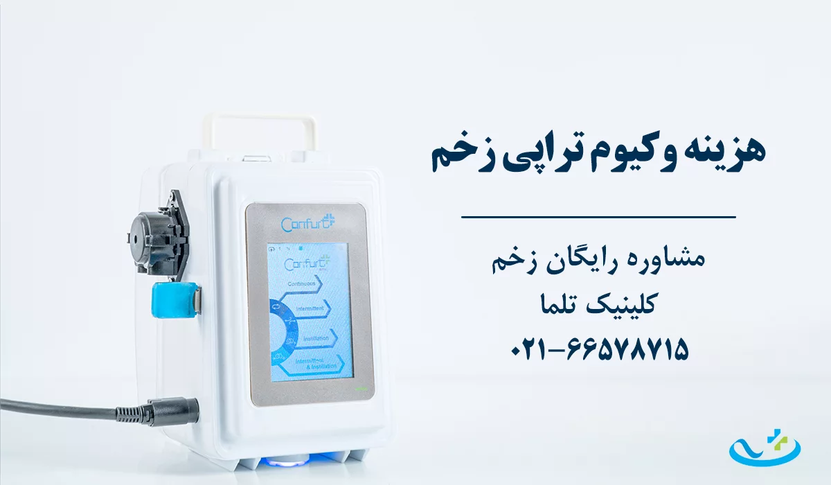 هزینه وکیوم تراپی زخم