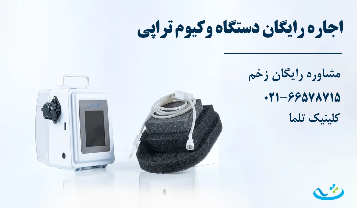 اجاره دستگاه وکیوم تراپی رایگان