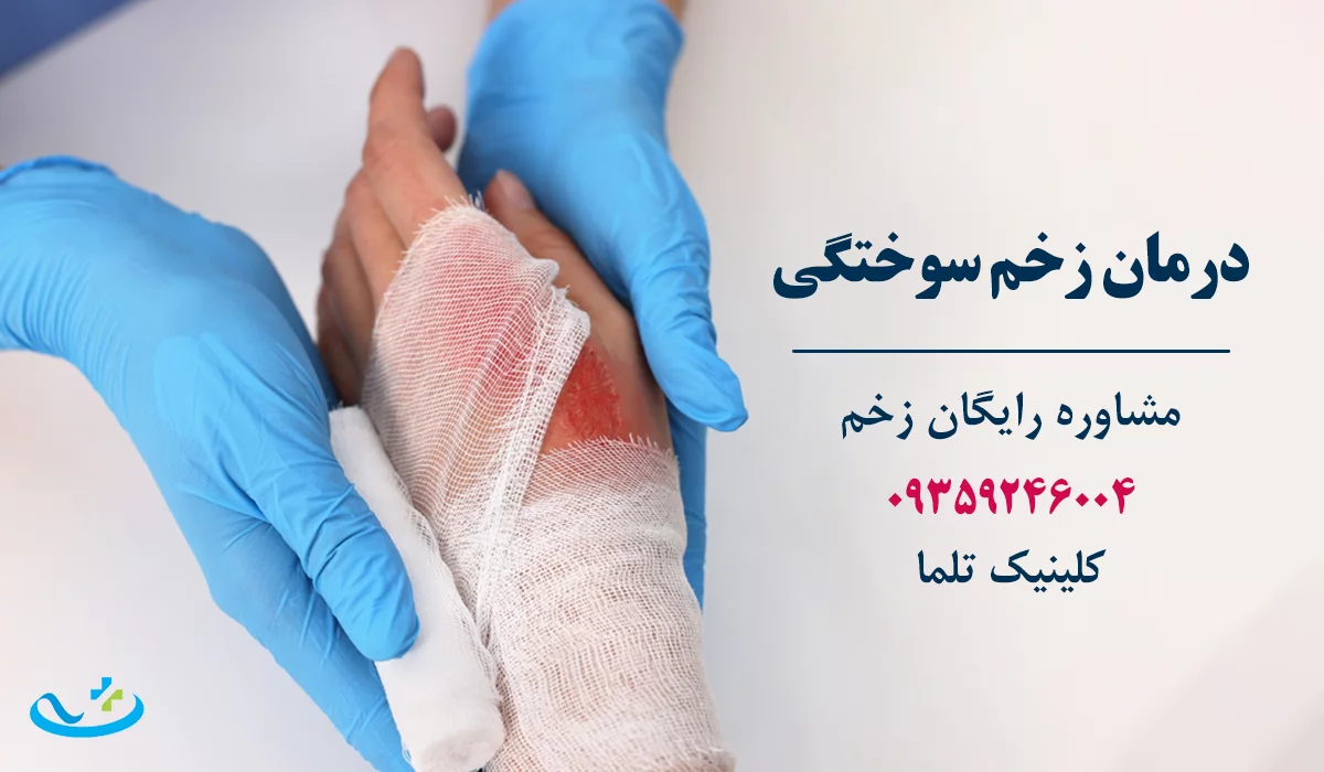 بهترین دکتر زخم تهران زخم سوختگی