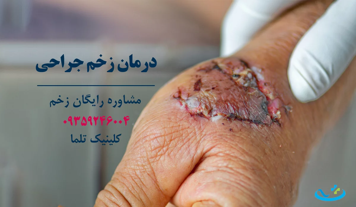 بهترین دکتر زخم تهران زخم جراحی