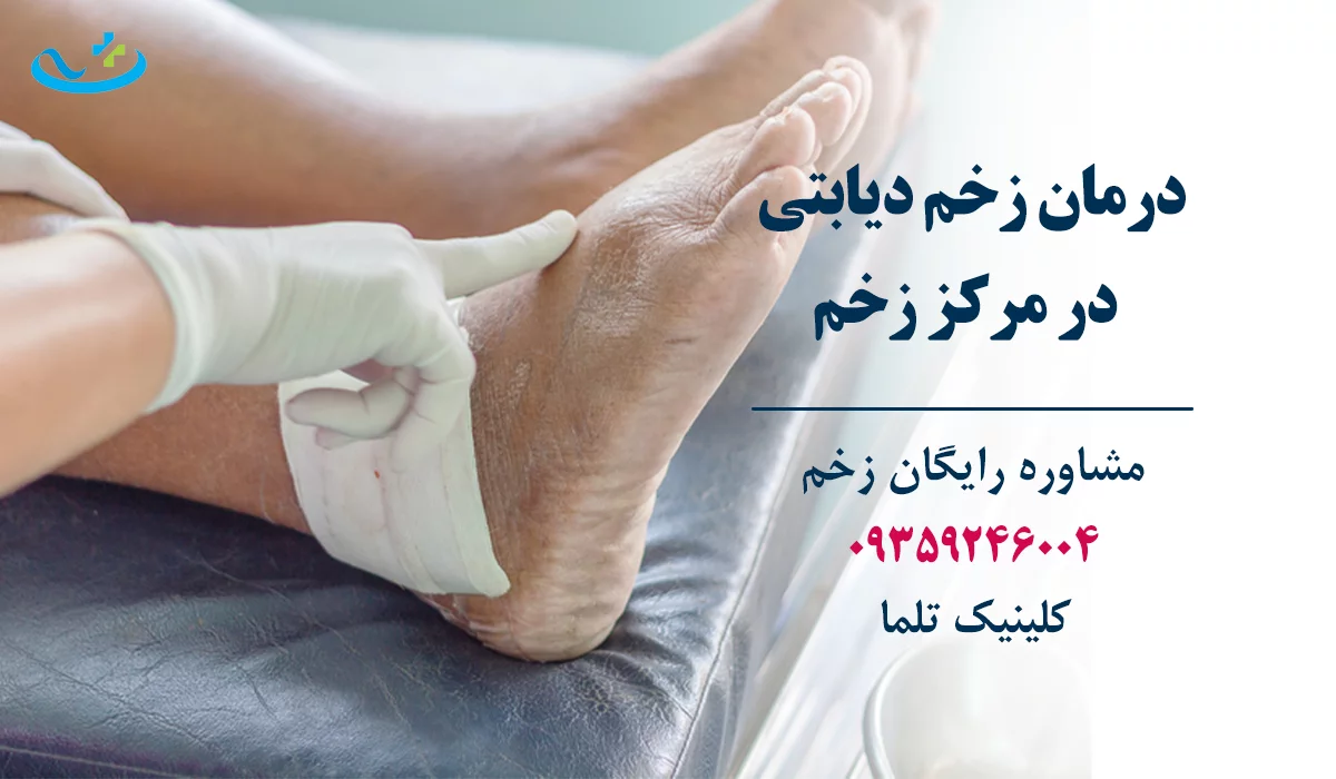 درمان زخم دیابتی بهترین دکتر زخم تهران