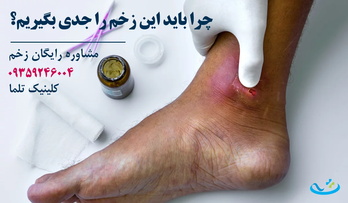دکتر زخم دیابتی تهران