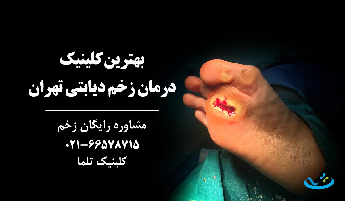 بهترین کلینیک زخم دیابتی تهران