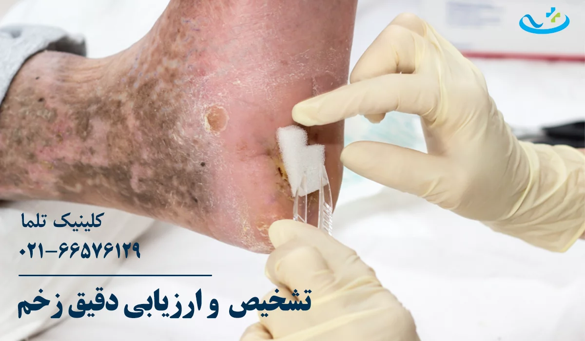 ارزیابی زخم در کلینیک زخم دیابتی تهران