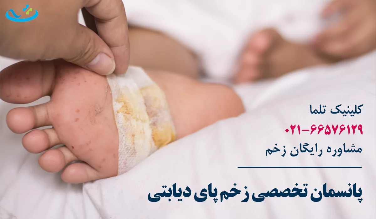 پانسمان زخم در کلینیک زخم دیابتی تهران