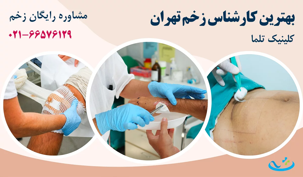 بهترین کارشناس زخم تهران
