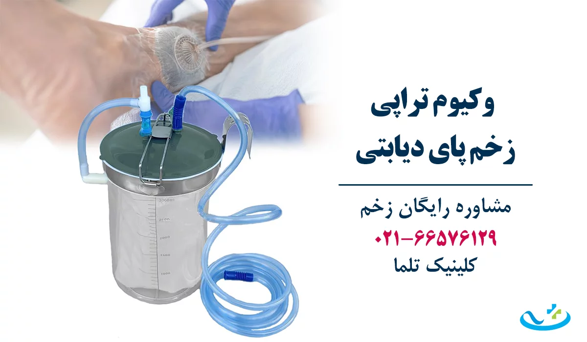 وکیوم تراپی زخم دیابتی