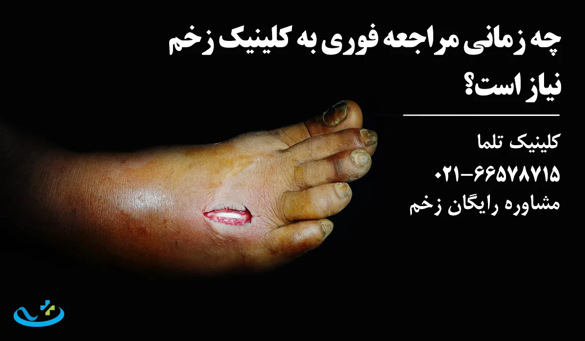 مراجعه فوری به کلینیک زخم