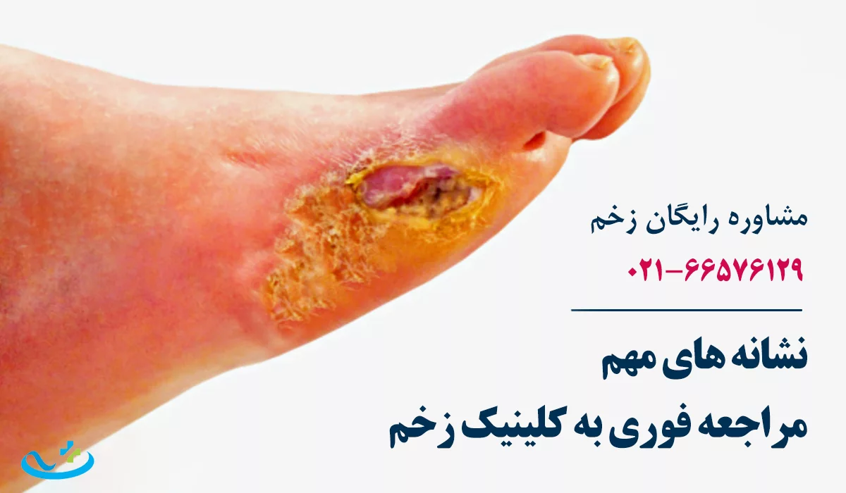 نشانه های فوری مراجعه فوری به کلینیک زخم