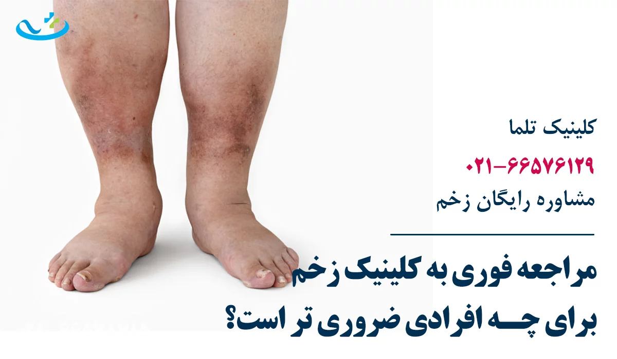 مراجعه فوری به کلینیک زخم