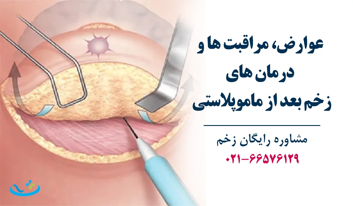 زخم بعد از ماموپلاستی