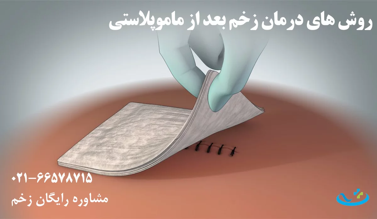 روش های درمان زخم بعد از ماموپلاستی