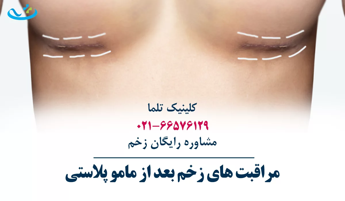 مراقبت های زخم بعد از ماموپلاستی